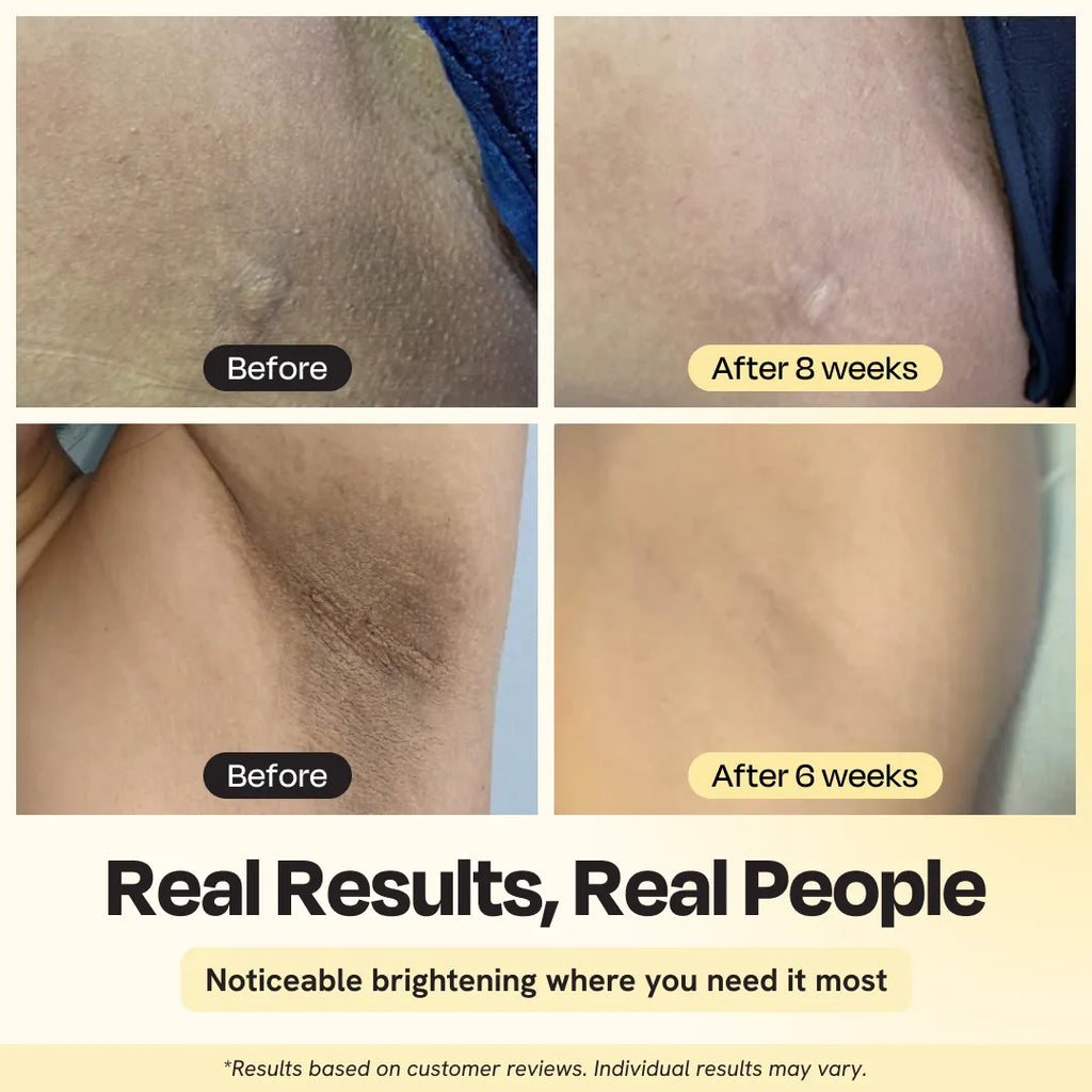 Gleamin Illuminating Intimate Serum – Brightening for Bikini Line & Underarms