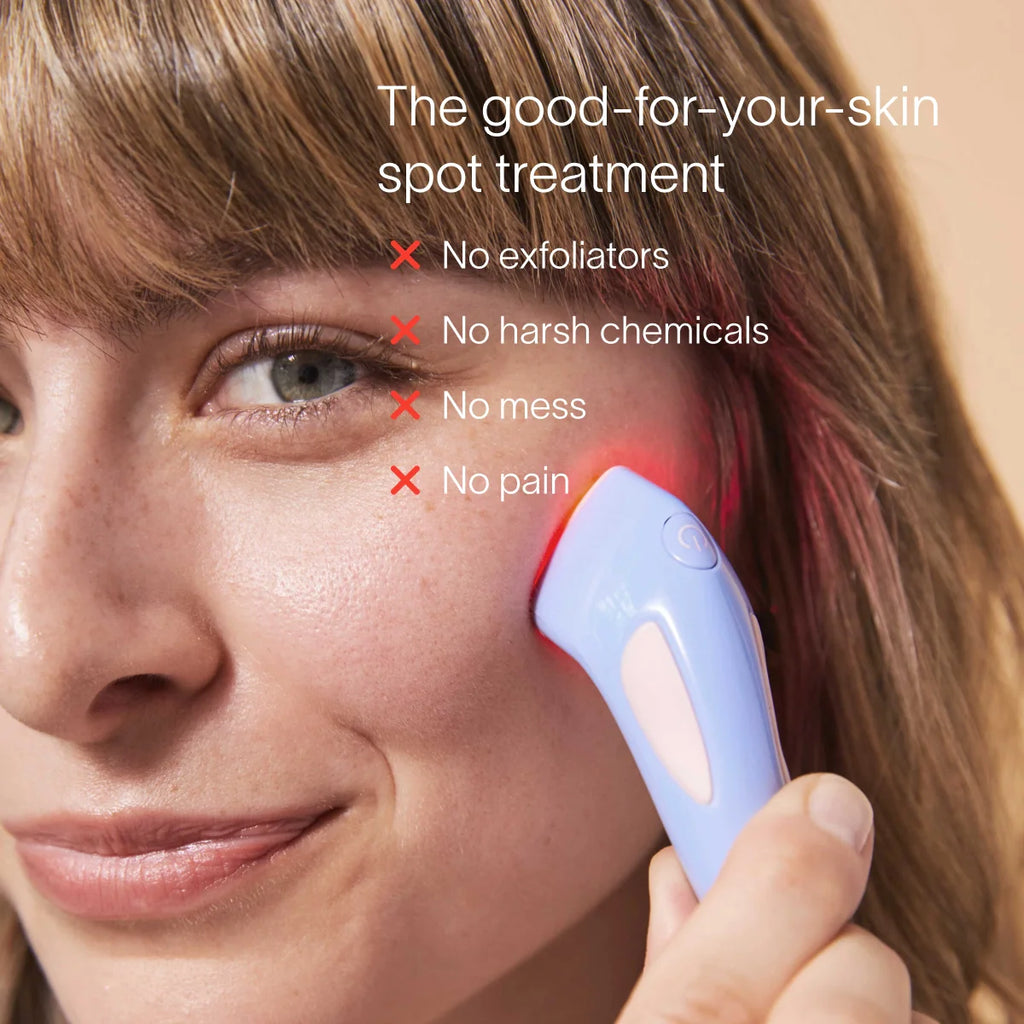 Solawave Bye Acne – 3-Minute Blue & Red Light Pimple Spot Treatment