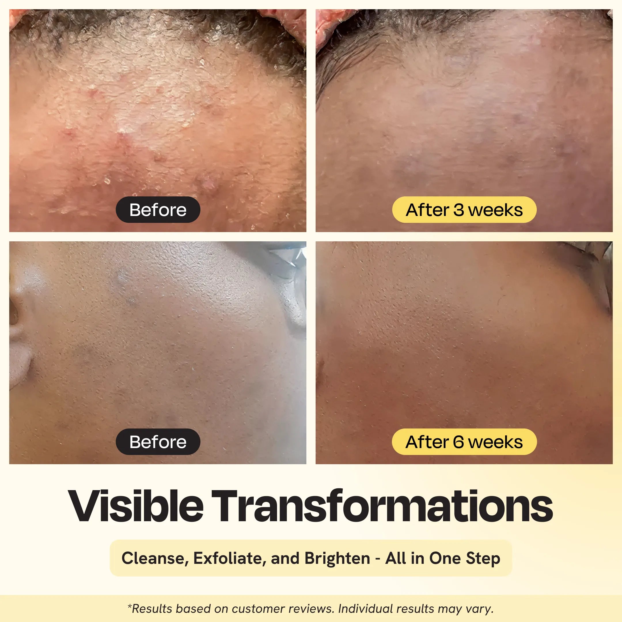 Gleamin Clarifying Brightening Cleanser – BHA + AHA + Vitamin C